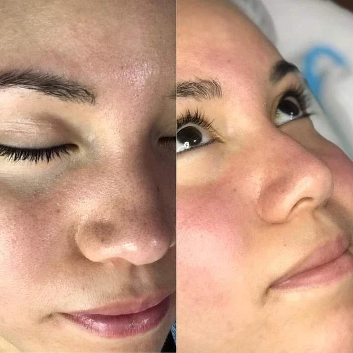 SkinWash Pro® Limpiador Facial Ultrasónico 3 en 1 + Molde para Hielo Facial