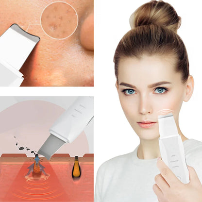 SkinWash Pro® Limpiador Facial Ultrasónico 3 en 1 + Molde para Hielo Facial
