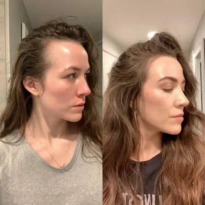 Cepillo Tratamiento Capilar - GlowTherapy® + Aceite VitaOil®